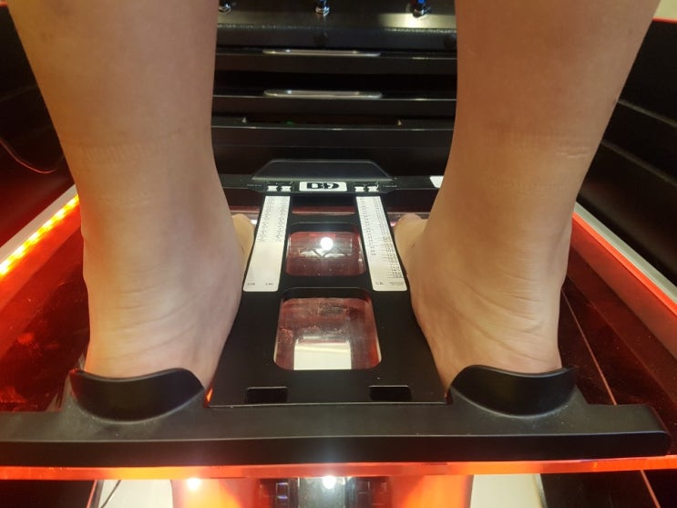  [대구맞춤깔창] 유연성평발 교정용 깔창제작