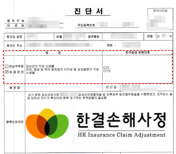 갑상선암 림프절전이 분쟁 건 해결한 케이스