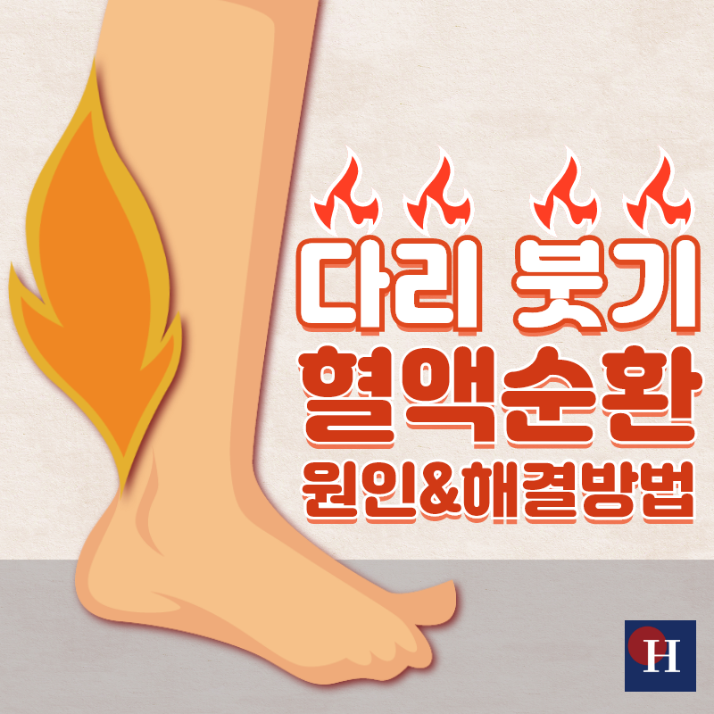 혈액순환장애 해결방법은?