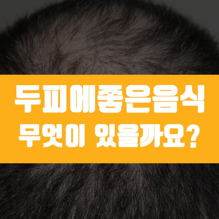  두피에좋은음식 이제 챙겨 먹어야 하나 봐요..