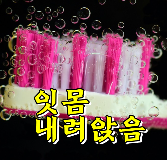  정기적인 치석제거로 잇몸내려앉음 예방하세요