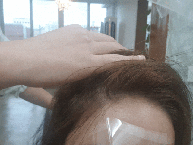  광주양산동미용실 14일그리고336시간 두피클리닉후기~