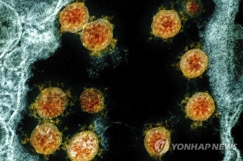 미국서도 코로나 재감염사례ᆢ 25세남성 재 감염때 더 아프다