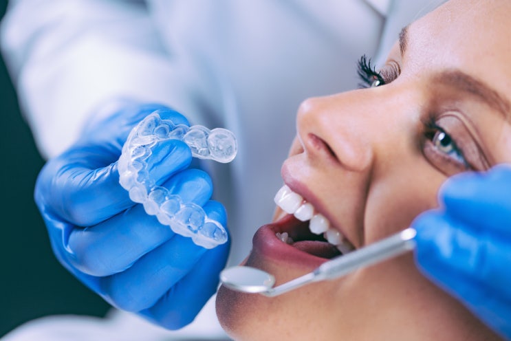 [인창동치과] 치아 미백 몇번해야 효과가 있을까요?