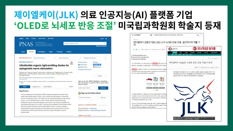  제이엘케이(JLK) 의료 인공지능(AI) 플랫폼 기업 - ‘OLED로 뇌세포 반응 조절’ 미국립과학원회 학술지 등재