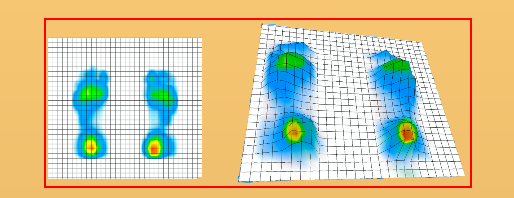 Foot Mapping Sensor System : 네이버 블로그