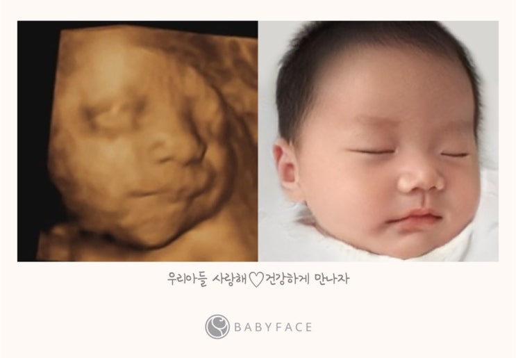 [임신 29주] 베이비페이스