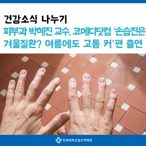 피부과 박혜진 교수, 코메디닷컴 '손 습진은 겨울질환? 덥고 습한 여름에도 고통 커'편 출연