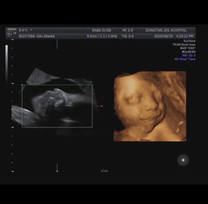 [임신29주] 기다리던 입체초음파