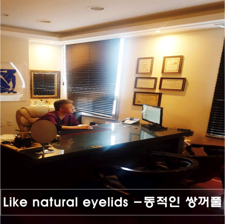  광주눈성형 상담가기 전에 꼭 먼저 해야 할 것