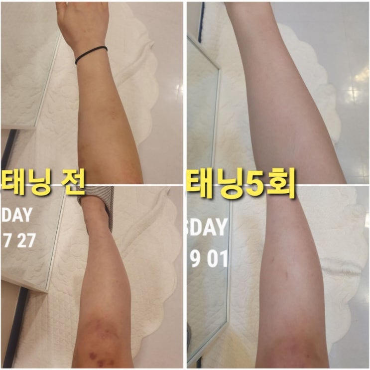  [광주왁싱] 뽑자슈가링 전대점에서 화이트태닝 5회한 후기