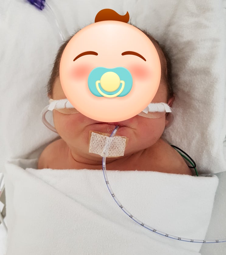 아기를 처음 만난 날-TTN(신생아일과성빠른호흡)