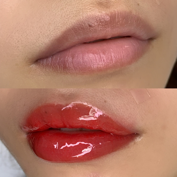  입술 색소침착 검은입술 틴트입술로 변신하기