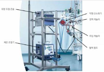  ECMO에크모정의 사용법설명 의료병원장비 : 캐뉼라 유량조절콘솔 ECMO