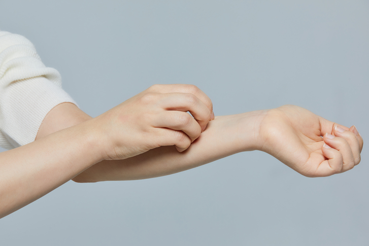 피부 알레르기 검사 병원, 만성 두드러기 검사, 치료, MAST 검사