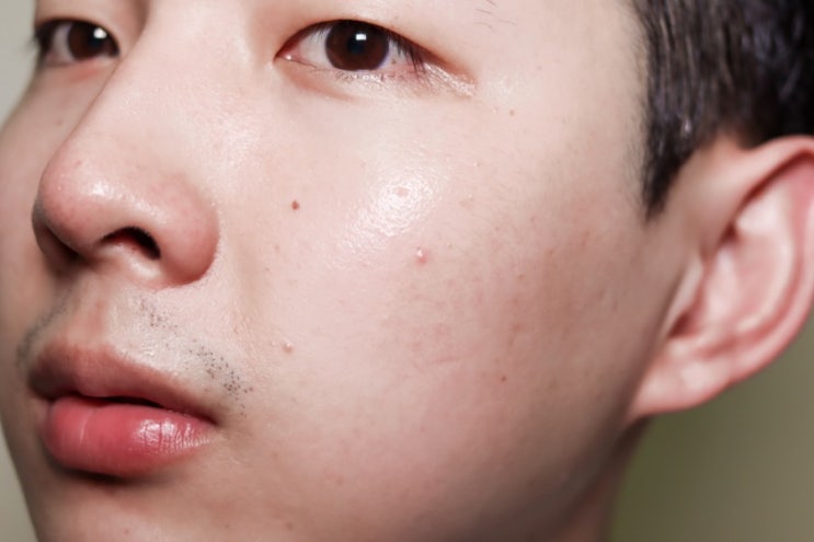  팔자주름 없애기 진짜로 가능한 팜스 무중력 리프팅팩