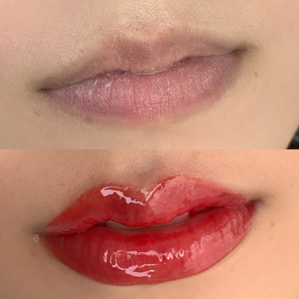  입술 색소침착 원인 및 관리 어두운입술 생기발랄하게 해결하기