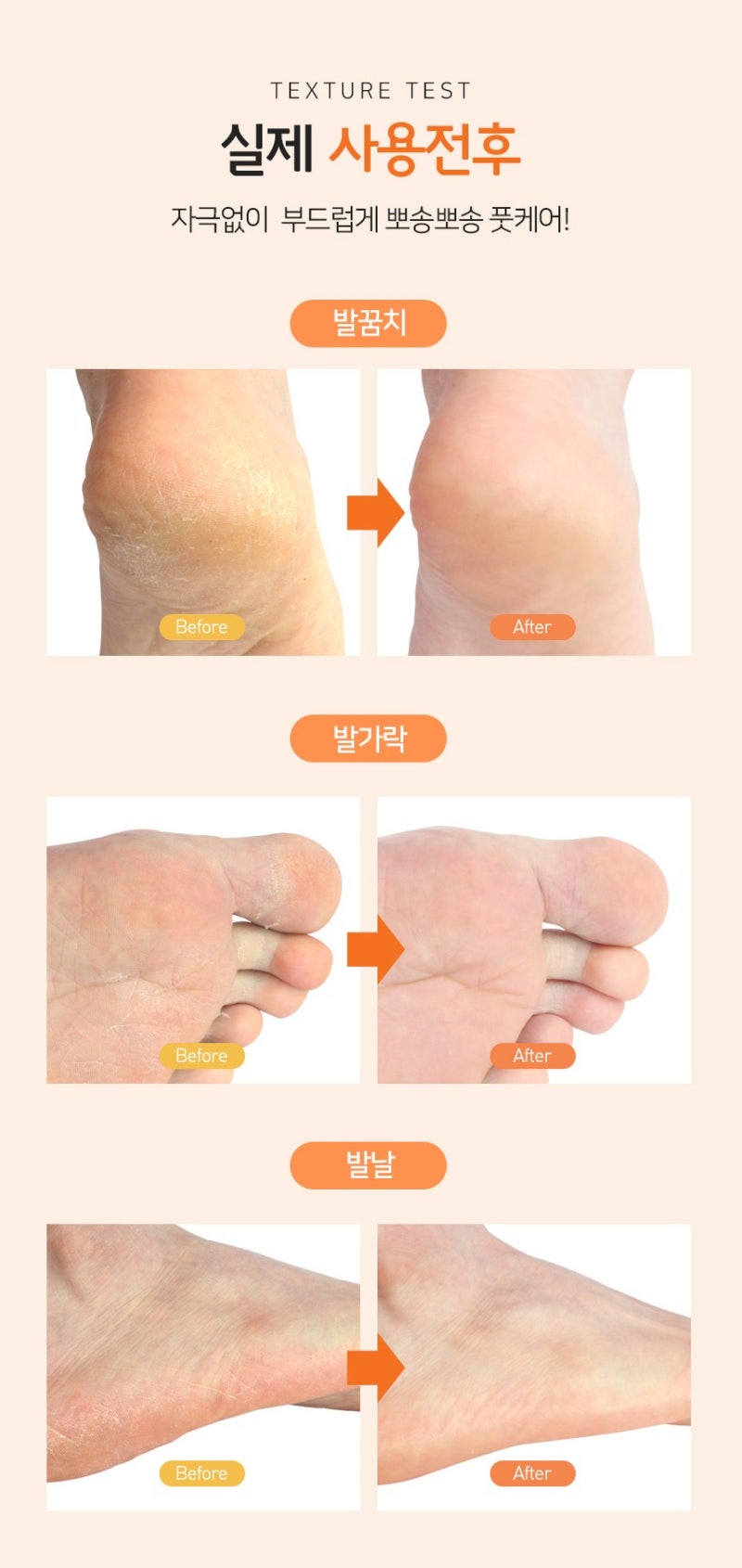 발뒤꿈치의 각질을 제거해주는 고보습 풋크림. 3