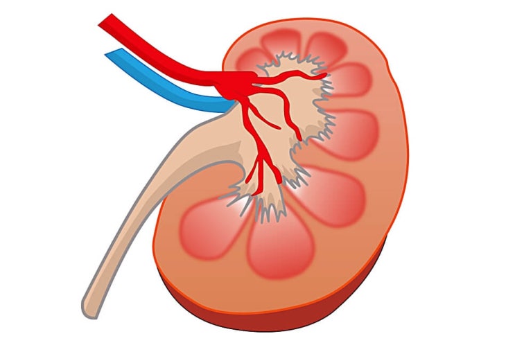 콩팥이 안좋으면 발생되는 증상
