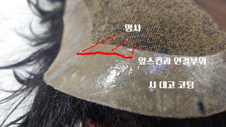  가발수선 앞스킨 과 망사연결 부위 찢어짐 인천가발수리