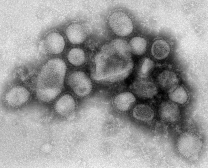 독감 예방접종은 언제? 증상은? 인플루엔자 바이러스