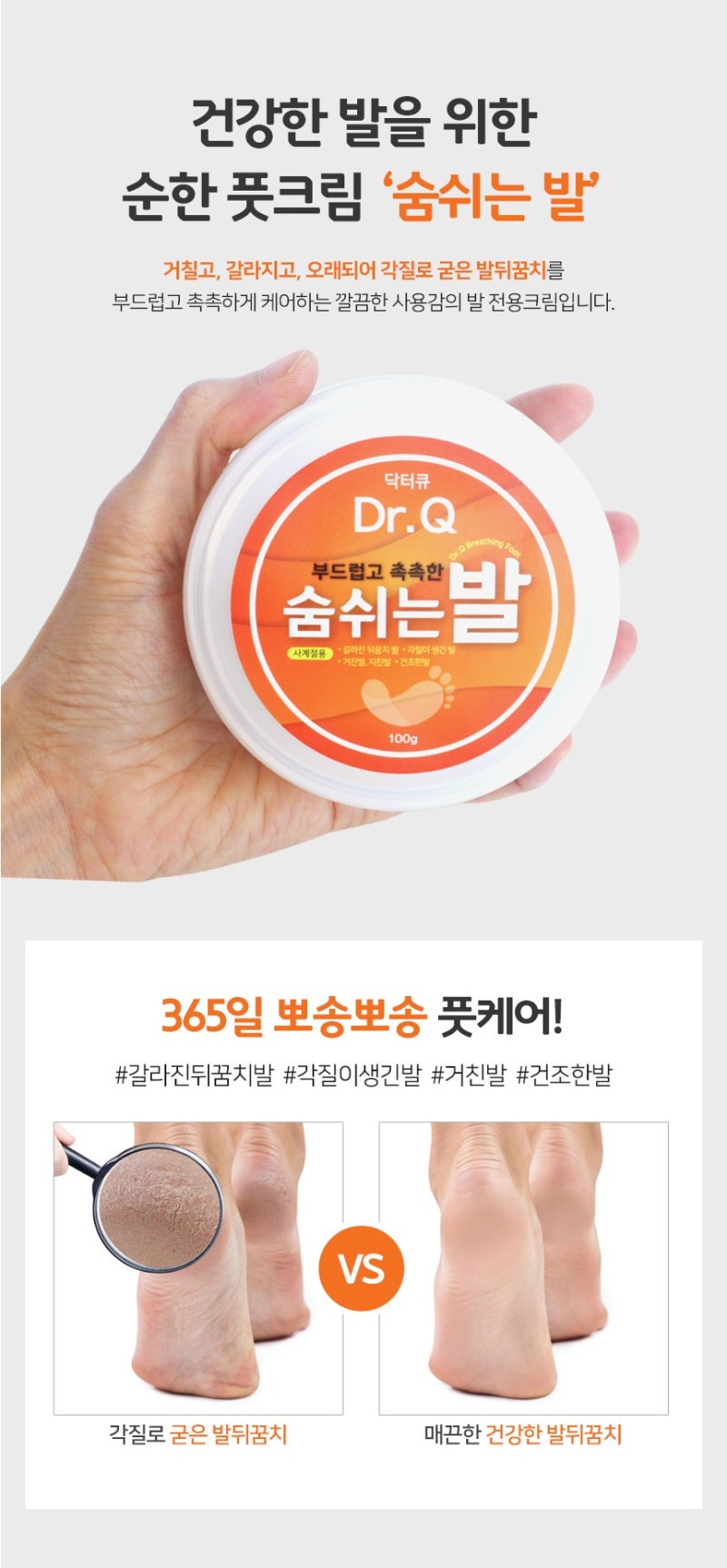 발뒤꿈치의 각질을 제거해주는 고보습 풋크림. 2