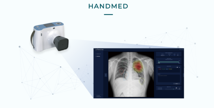  제이엘케이(JLK) 에이아이허브(AIHub) - HANDMED 이동형 X-ray 카메라와 결합한 폐 질환 분석 솔루션