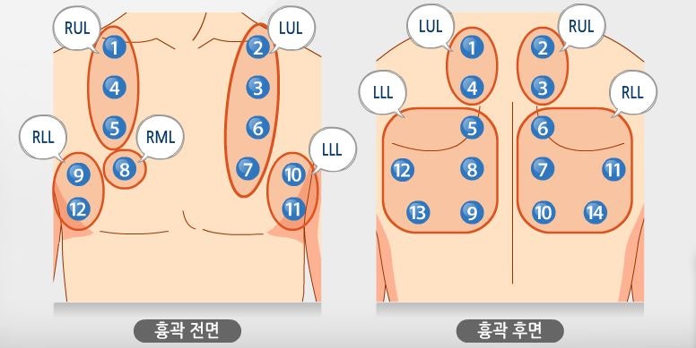 중환자실 간호사 신체사정: 폐음 : 네이버 블로그