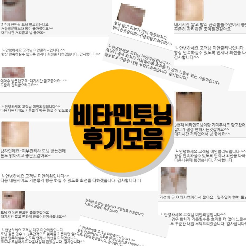 대구 기미제거에 좋은 대구토닝레이저 후기