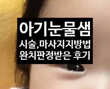  아기 눈물샘 시술, 마사지방법, 완치판정 받은 후기