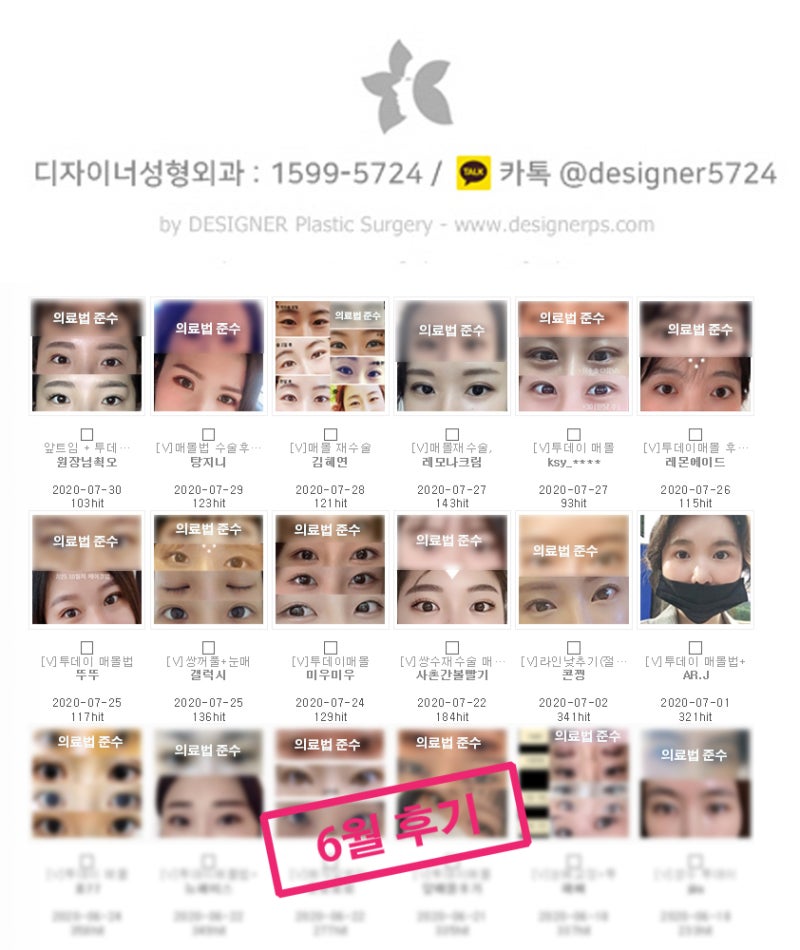 효과 빠른 쌍수 멍크림 (일차별 후기