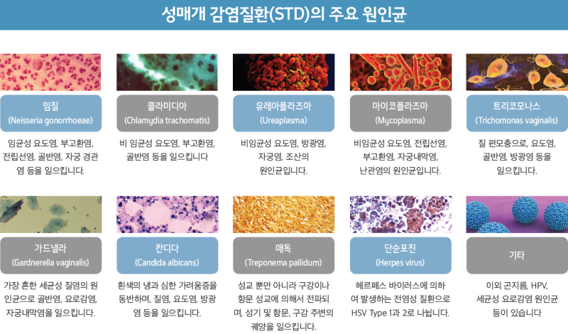 Mycoplasma hominis는 성병입니까? 7