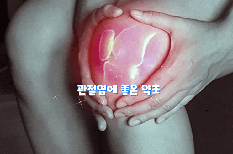 관절염에 좋은 약초 관절염에 좋은 약초