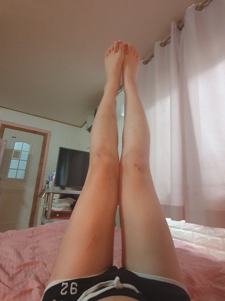  [레그크림추천] 다리붓기에는 닥터로드 레그 릴렉싱 겔크림