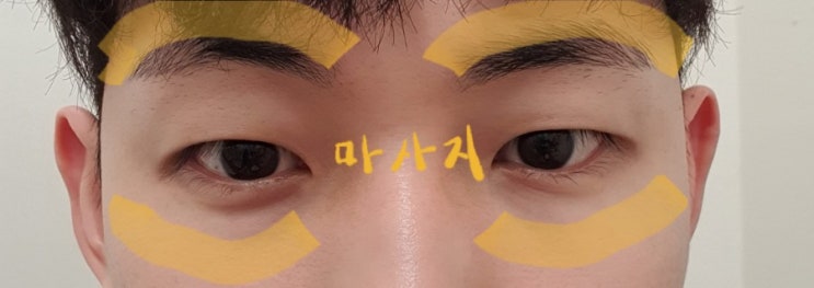  몸과 얼굴이 붓는 이유와 부기 제거 마사지 및 꿀팁