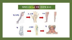  정맥주사iv술기 iv순서준비물주의사항 : 주사부위 합병증간호중재 수액세트종류