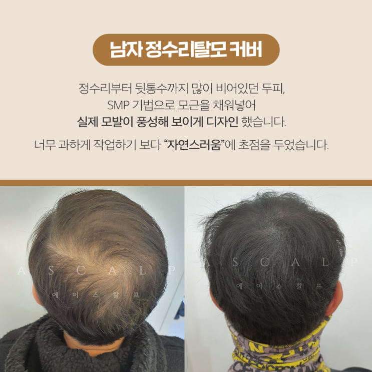  울산헤어라인 합리적으로