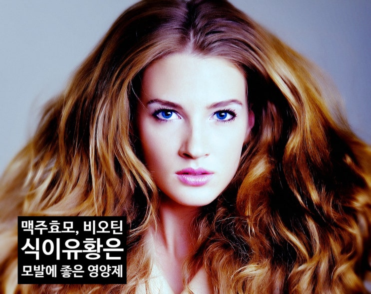  여성탈모는 남성탈모와 다르다!!