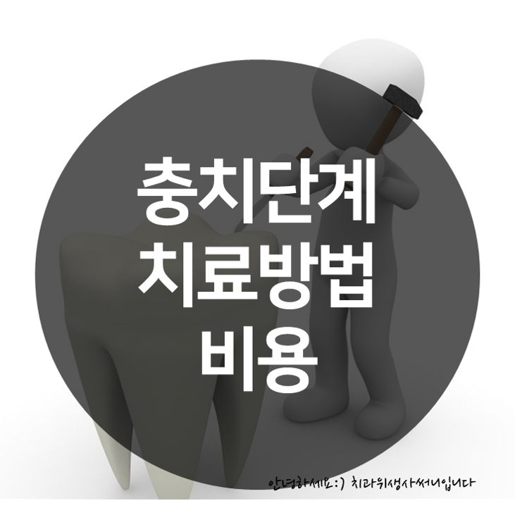  충치 단계에 따른 증상과 치료 방법 비용 :: (feat.치과위생사)