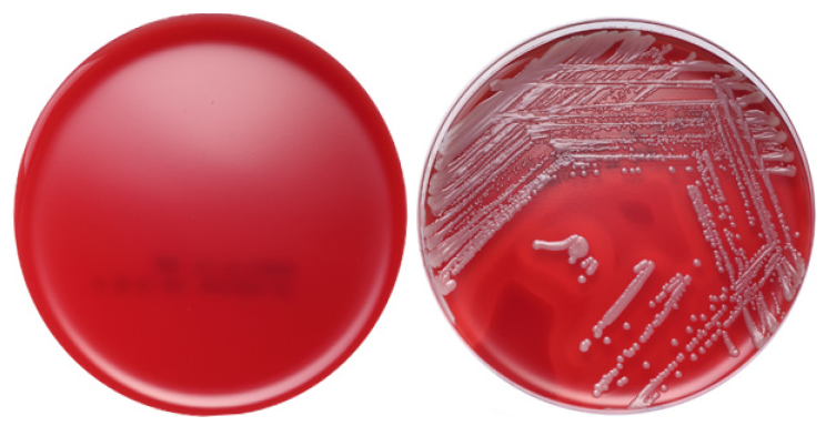BAP(Blood Agar Plate) - 혈액한천배지 : 네이버 블로그