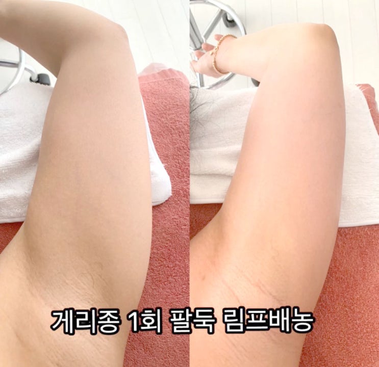  피부미인 부럽다면? 왁싱&피부관리샵 제주도민 최대 54% 할인정보! (제주시 노형)