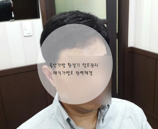 울산 남자가발, 정수리 탈모 맞춤가발로 완벽 보완! 6