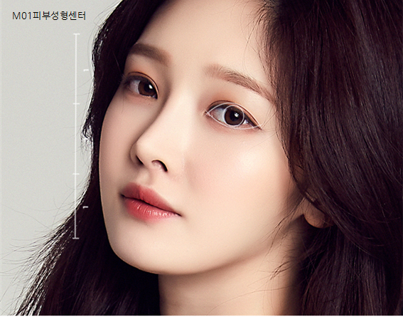  부평 쌍꺼풀 절개 두툼한 눈매를 슬림하고 자연스럽게
