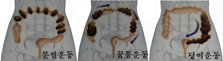  위장 순환에 좌우되는 한국인의 대장암
