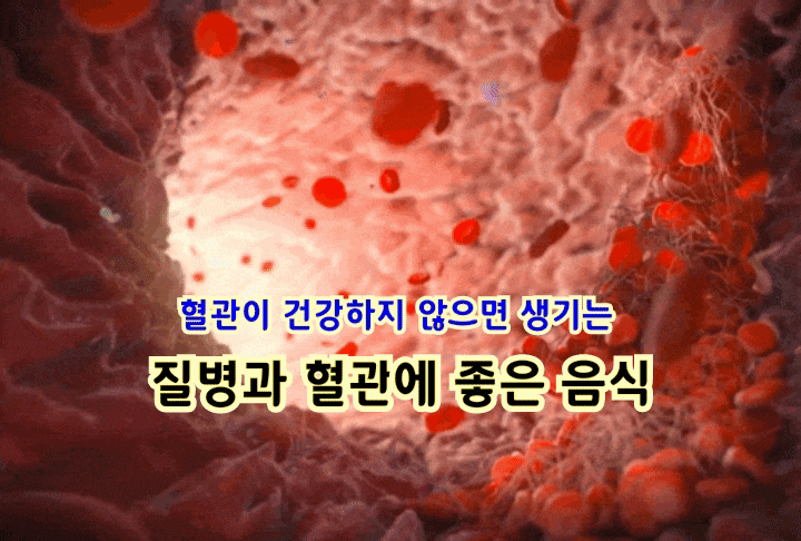 혈관이 건강하지 않으면 생기는 질병과 혈관에 좋은 음식 혈관이 건강하지 않으면 생기는 질병과 혈관에 좋은 음식