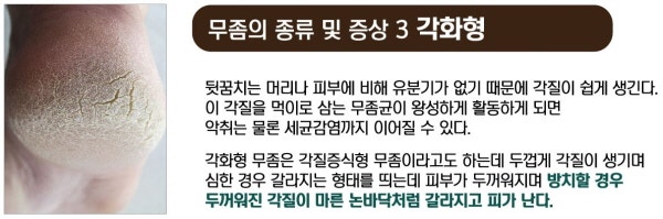 발각질 체계적인 관리는 페디아이티엔 (전국지점)