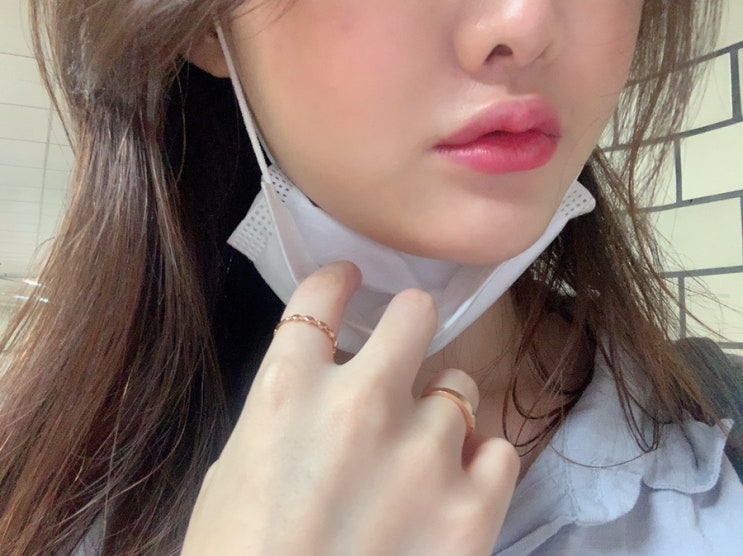  브잉라인 레인보우 스텝 솔루션 1회차 / 왕십리 피부과에서 윤곽주사와 스킨부스터를 한번에