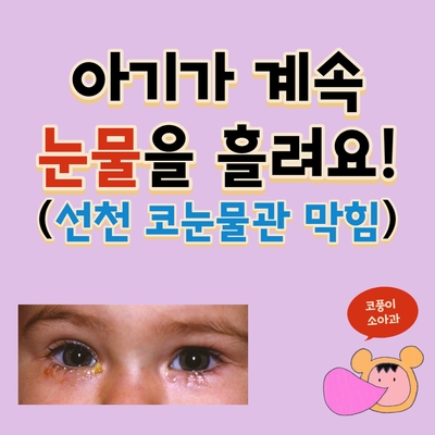  아기가 계속 눈물을 흘려요!(선천 코눈물관막힘, 눈물길 폐쇄, 눈물주머니 마사지)