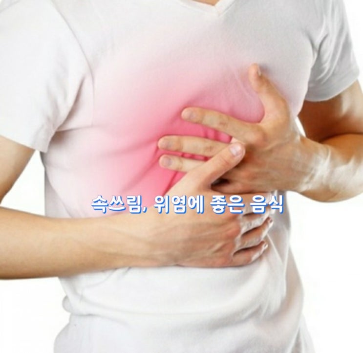 속쓰림, 위염에 좋은 음식 속쓰림, 위염에 좋은 음식