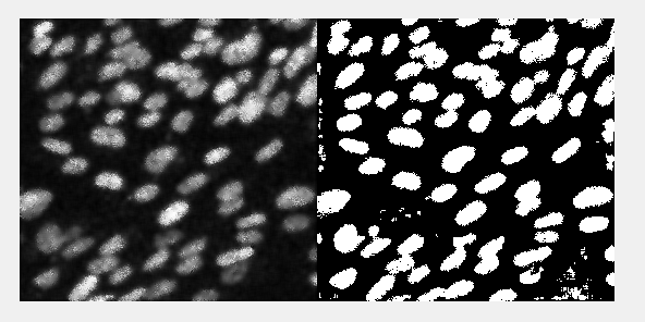[MATLAB] 세포의 갯수를 측정하는 코드만들기 : 네이버 블로그